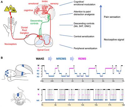 Effect of sleep loss on pain—New conceptual and mechanistic avenues